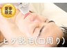 【夏季限定♪】青ヒゲパーツ脱毛 3,000円 / 痛み抑制◎/ 医療乗換多数◎