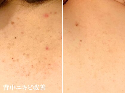 アクール(Accueil)の写真