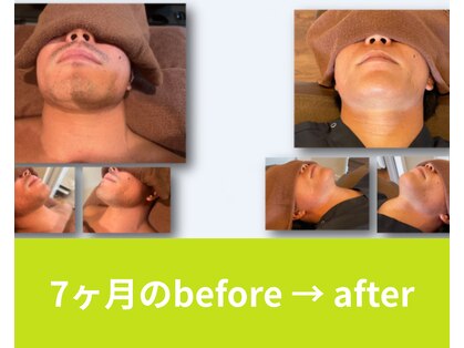 パインビューティー(PINE beauty)の写真