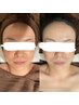 【キメを整え美肌に】毛穴レスくすみ改善うる艶肌細胞ケア♪¥14000→¥13200