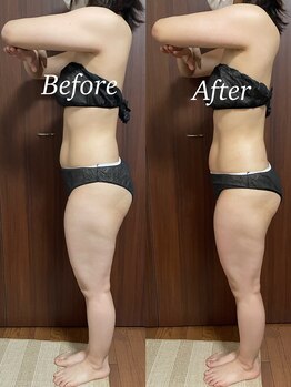 ヴィム(VIM)/ハイパーナイフビフォーアフター