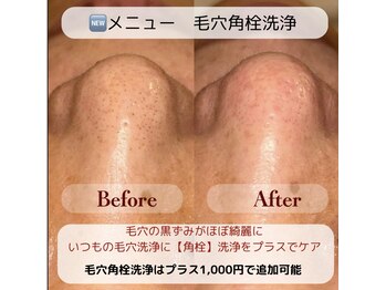 ファースト(1ST)