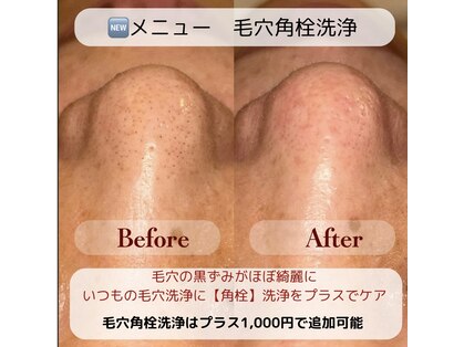 ファースト(1ST)の写真