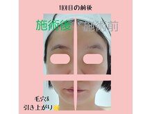ほしにはろーの雰囲気（毛穴保湿たるみケアに！）