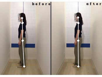 今津ぴっと骨盤整体院/ビフォーアフター3