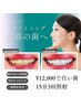 【この４回でしっかり白い歯へ】4回来店(15分照射3回) 23,920円→12,000円