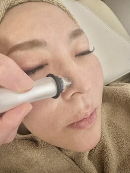 プライベートサロン コンネ(conne)の写真/気になる箇所を徹底ケア！毛穴の黒ずみ・開きを改善！気になる毛穴の開き・たるみも改善します♪
