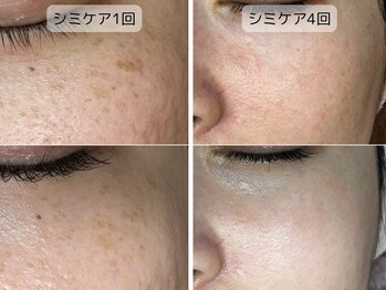 しらゆき 名古屋黒川