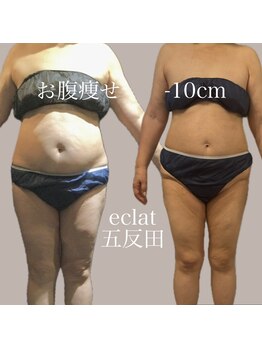 エクラ 五反田(eclat)/おなか-10cm/60代/五反田/痩身