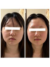 ジャスミン(Jasmine)/