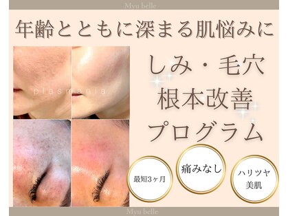 【 シミ・毛穴根本改善フェイシャル 】Myubelle-ミュベル-の写真