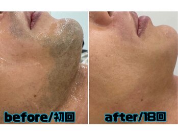 エリクサー 太田店(Elixir)/こんなに綺麗に!