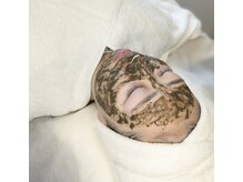 ララ オートクチュール(LALA HAUTOCOUTURE)の雰囲気（あなたは絶対仕上がりに驚く、オリジナルハーブピーリング）