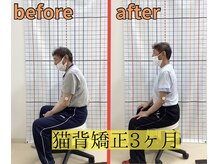 きずな鍼灸整骨院 武蔵ヶ丘本院/猫背矯正
