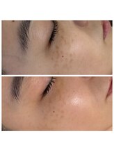 ジャスミン(Jasmine)/