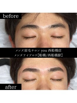 ユー 西船橋店(you)/ビフォーアフター写真