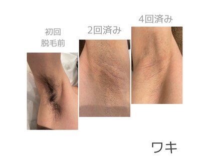リノアカーム(Linoa calm)の写真