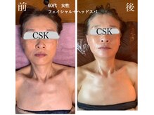 シーエスケイサロン(CSK salon)/フェイシャル＋ヘッドスパ