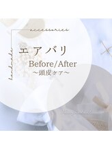 美バリ 新宿店(美BARI)/毛根幹細胞44％入り培養液導入