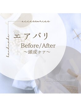 美バリ 新宿店(美BARI)/毛根幹細胞44%入り培養液導入