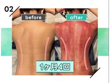 スピード美人 銀座店/銀座で短期集中ダイエット♪