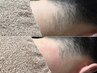 【2回目以降】フェイシャルワックス+保湿うるつやパック+(うなじWax) 