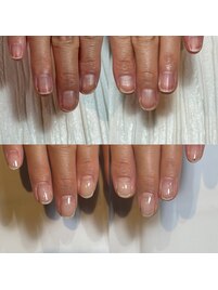 看護師のお客様の自爪育成