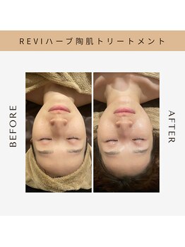 ブリエ(BRiLLER)/#REVI陶肌トリートメント