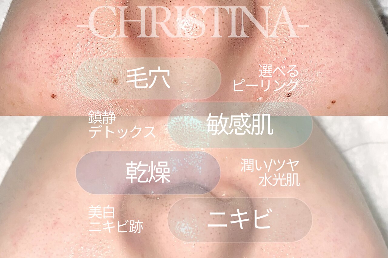 ラジオ波 キャビテーション 宇都宮に関するサロン 痩身/ハイパーナイフ