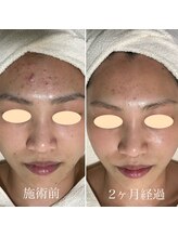 シェノン 赤坂大濠店/