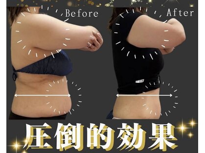 ラフィールの写真