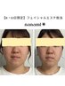 【19・22・29限定/NANAMI担当】クイック３０分facial★小顔リフト×透明度UP