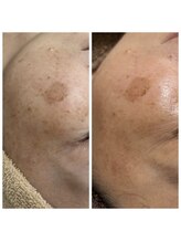 ジャスミン(Jasmine)/