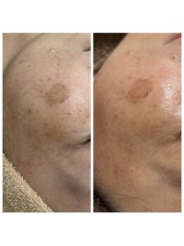 ジャスミン(Jasmine)/