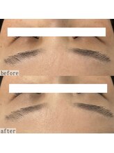 ヴェルシック(Belchic)/瞼までしっかりとケアができる