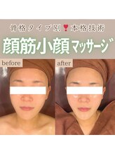 エステ ココ 荻窪店(Esthe CoCo)/美肌/肌管理/毛穴