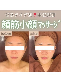 エステ ココ 荻窪店(Esthe CoCo)/美肌/肌管理/毛穴