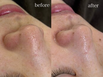 テオリア(TEORIA)/