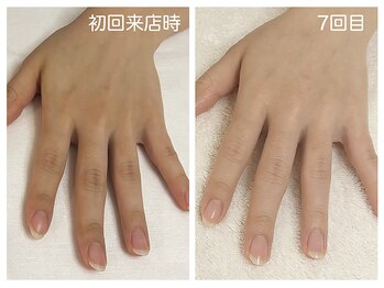 キレイテ 上野店/30代/7回目【ハンドケア上野】
