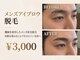 ブロンズ(Bronze)の写真