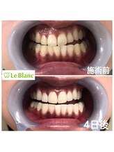 ルブラン 奈良店(Le Blanc)/フリーパス途中経過