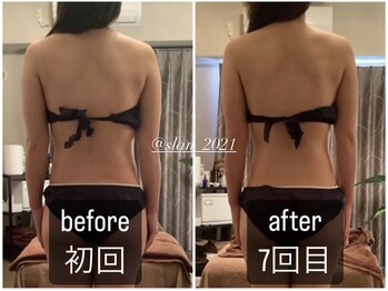 スラン(Slan)/美骨痩身×筋膜リリース90分