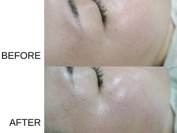 アニュ(a nu)/艶々感激のフェイシャルワックス