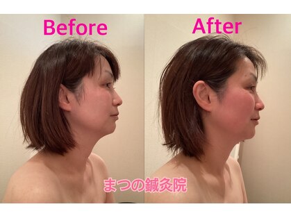 まつの鍼灸院の写真
