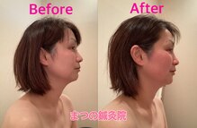 まつの鍼灸院