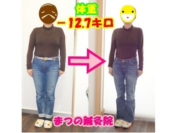 まつの鍼灸院/12.7キロ痩せて若々しい見た目に