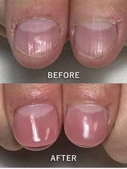 ポメロ(POMELO)/爪の先端を保護しながらカバー