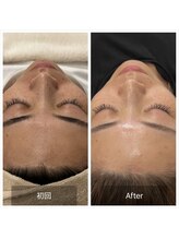 ウィズ ユー ビューティ(with U beauty)/お肌が綺麗に