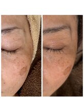 ジャスミン(Jasmine)/