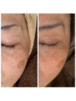 ジャスミン(Jasmine)/